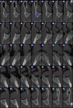 Les maladies des gencives